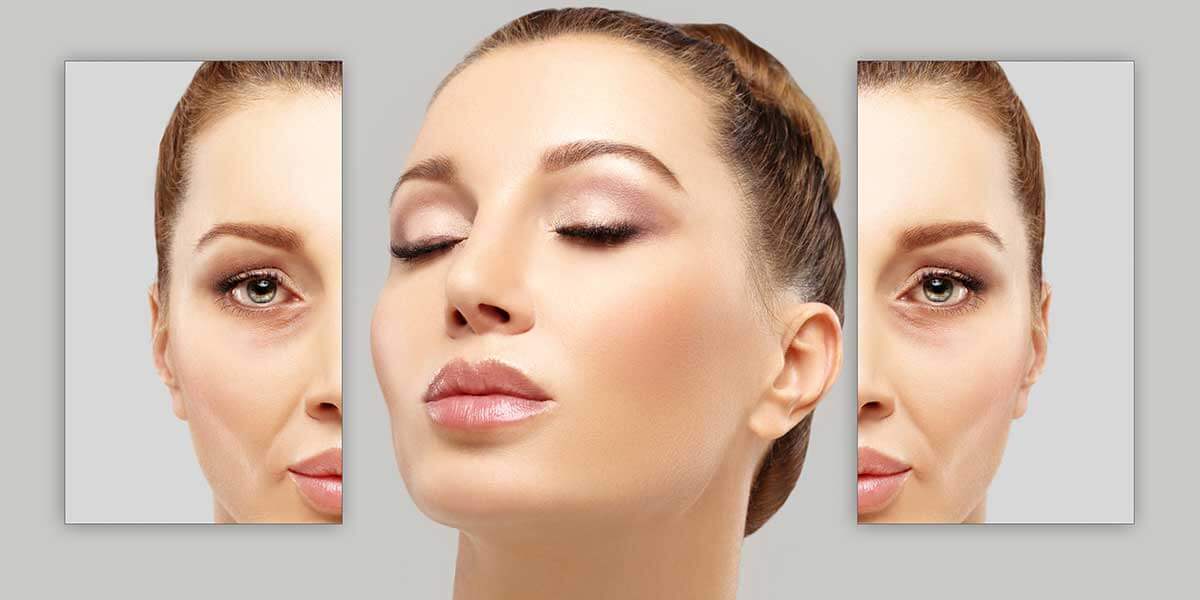مزایا و معایب استفاده از بوتاکس