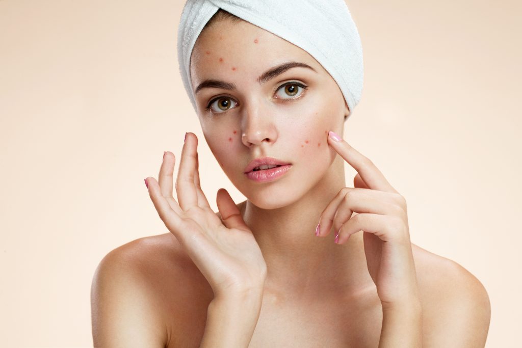 چرا دچار لک های پوستی می‌شویم؟