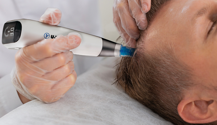 میکرونیدلینگ و کوکتل‌تراپی مو